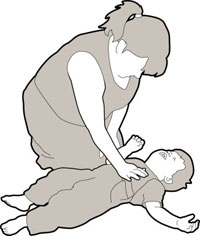 Реанимация ребёнка массаж сердца